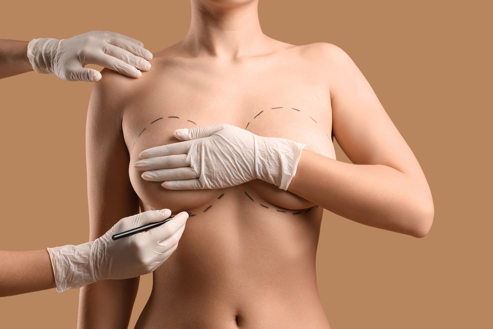 breast lift nipple repositioning